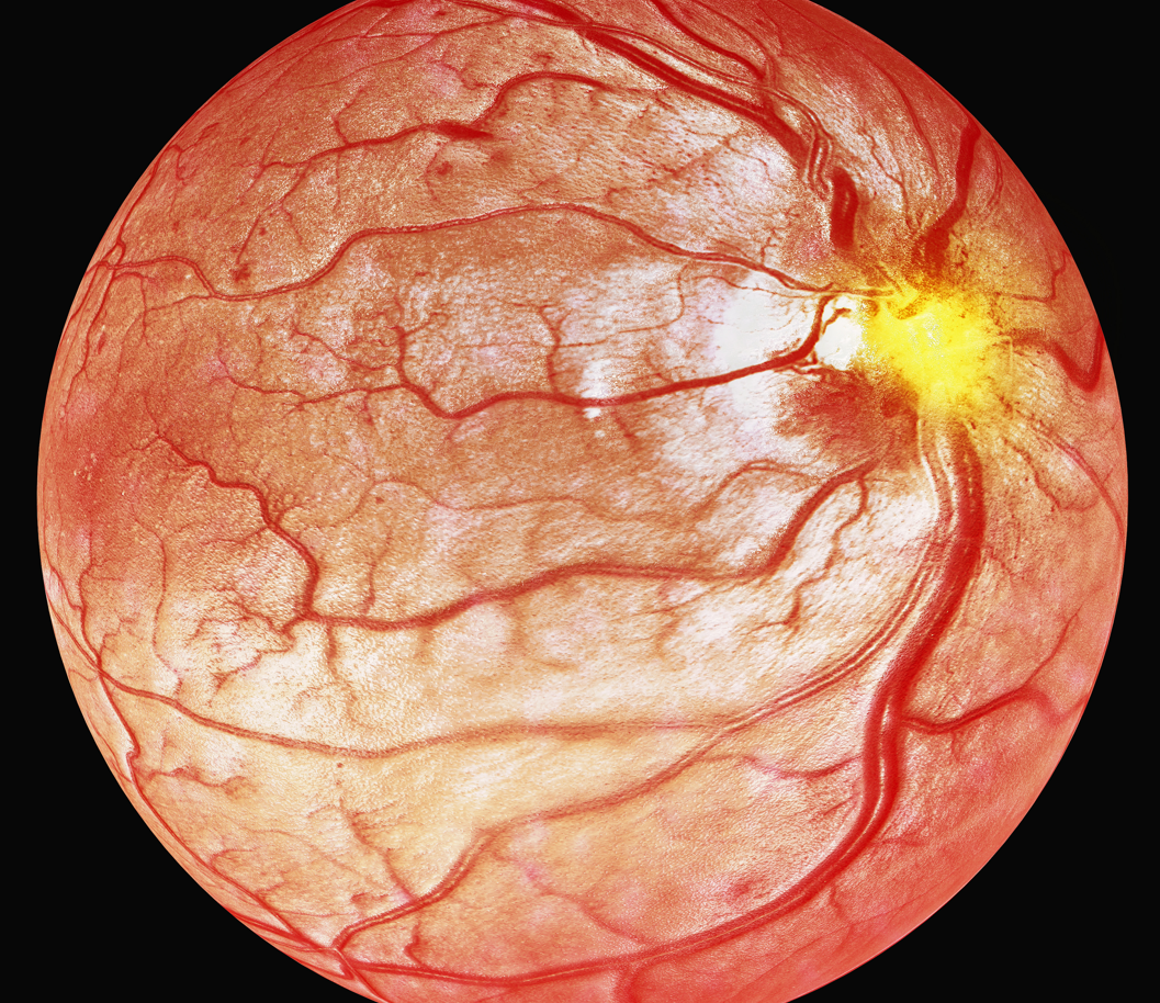use domains for Optical coherence tomography